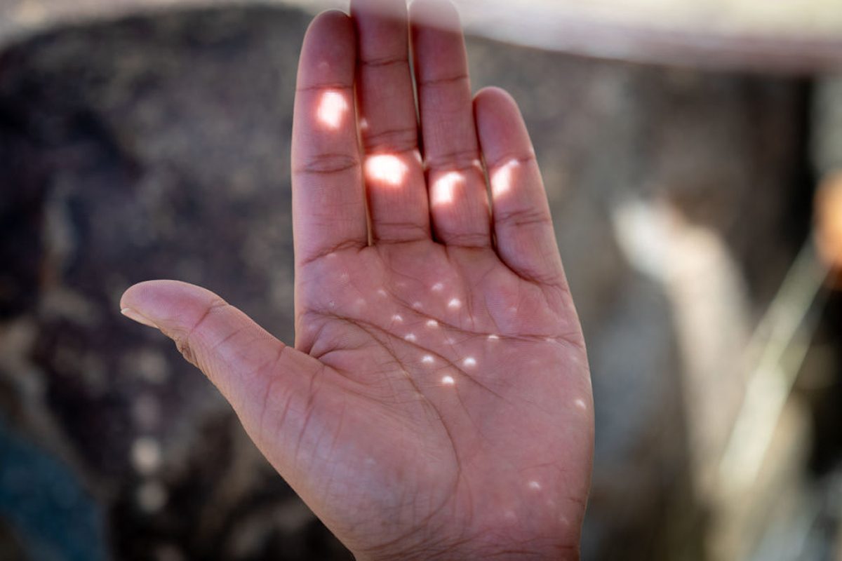 Hand held out catching crescent-shaped shadows of an eclipse projected through a sieve.
